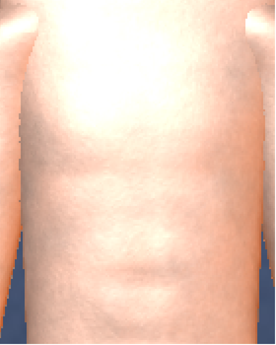 skin with micro-relief