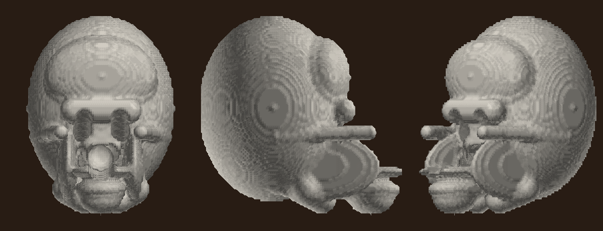 the machine-fitted skull