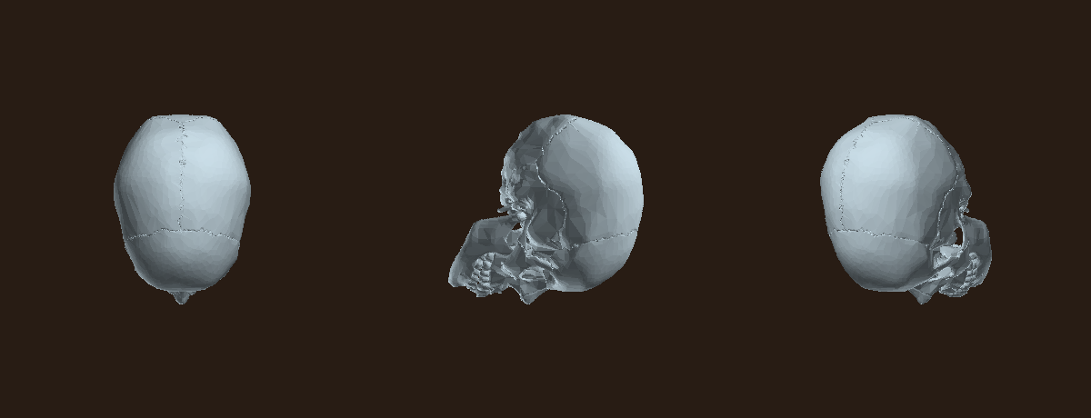 Three views of a real scanned human skull