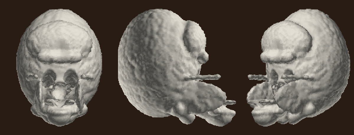 skull render after the fix: continuous pebbled bone texture, ring pattern gone